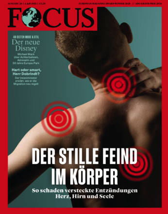 FOCUS